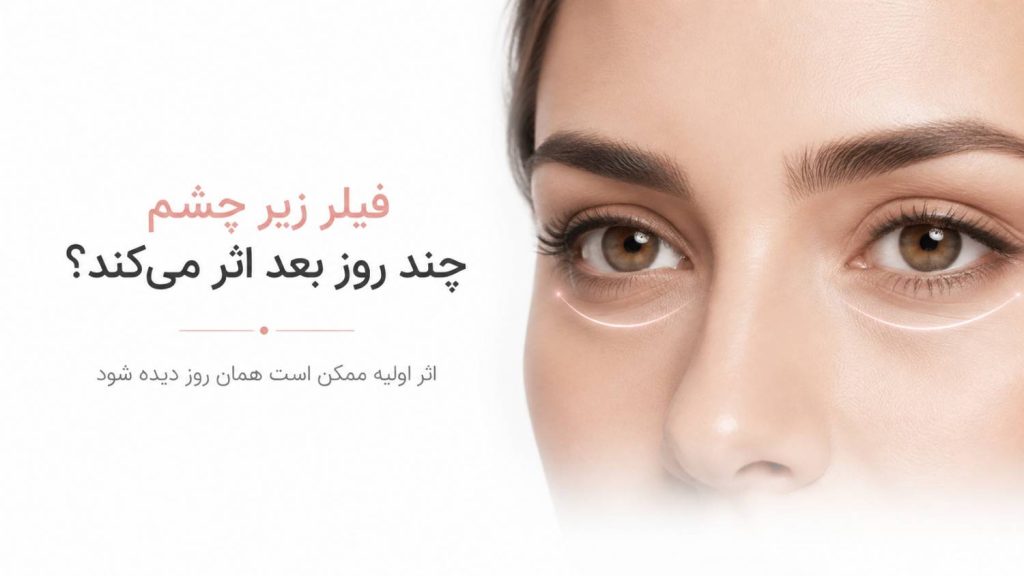 فیلر زیر چشم چند روز بعد از تزریق عمل میکند