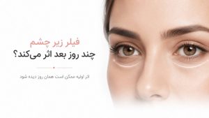 فیلر زیر چشم چند روز بعد از تزریق عمل میکند
